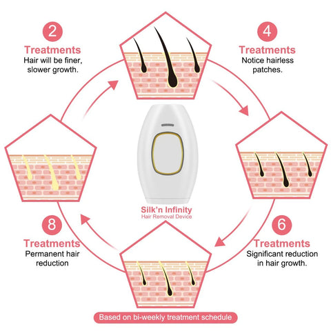 IPL Hair Removal Laser Epilator